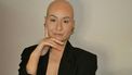 alopecia