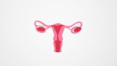 endometriose kliniek