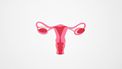 endometriose kliniek
