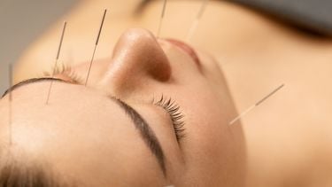 acupunctuurpunt rimpels
