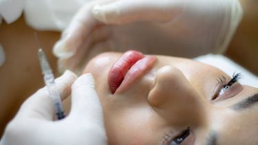 Voor botox worden nog altijd dierproeven gedaan: ‘Onbegrijpelijk en niet nodig’